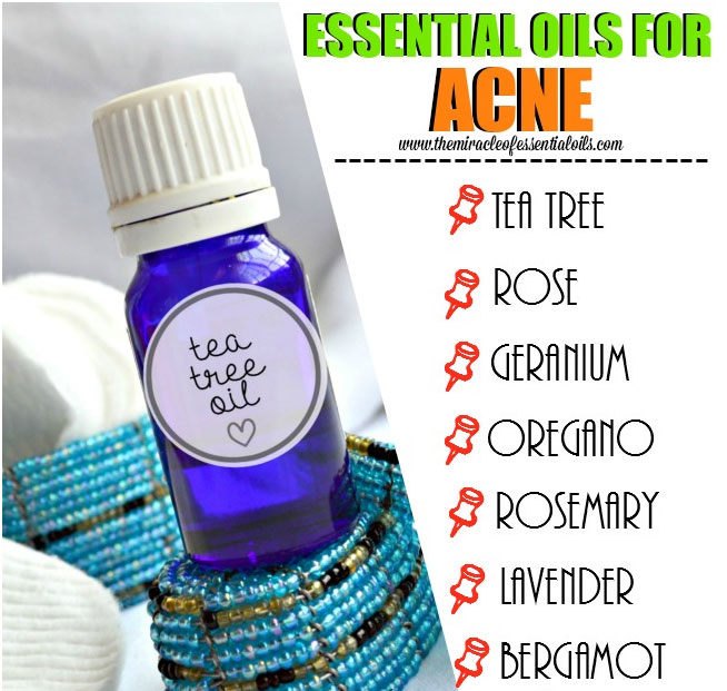 essentialoilsforacne