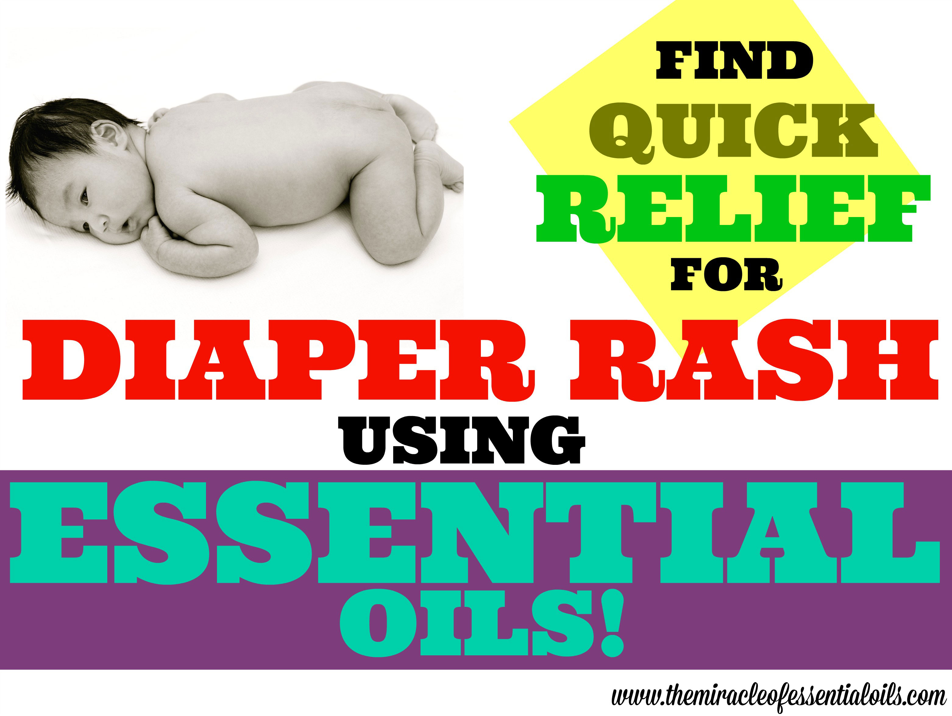 Top 5 Essential Oils for Diaper Rash in Babies