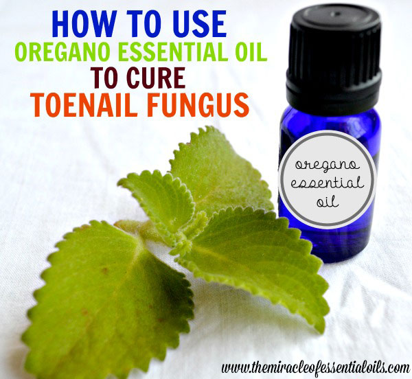 Using Oregano Essential Oil for Toenail Fungus | A Natural Treatment