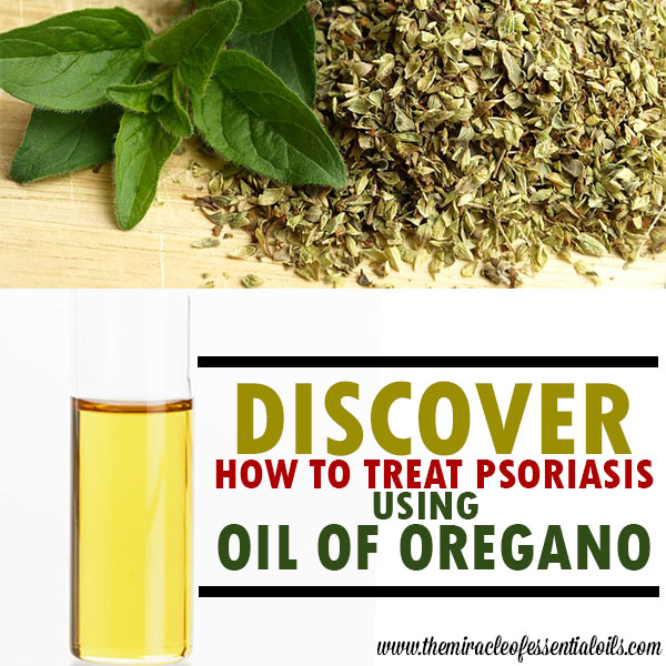 oil of oregano psoriasis treatment