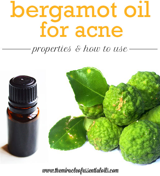 bergamot oil for acne