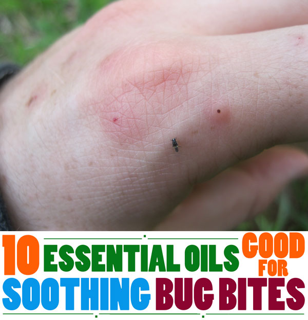 essential oils for bug bites