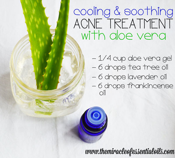 Antibacterial Acne Essential Oil Recipe