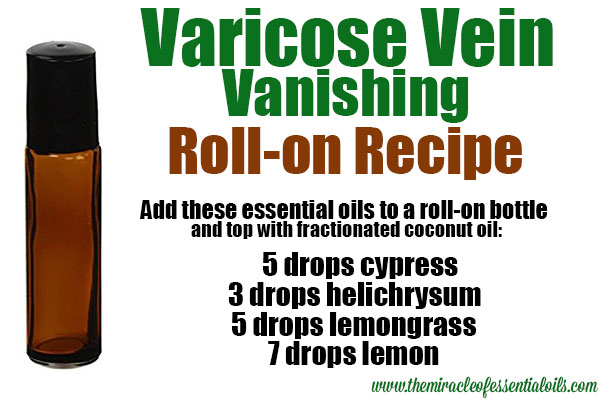 Homemade Essential Oil Recipe for Varicose Veins | Roll-On Remedy