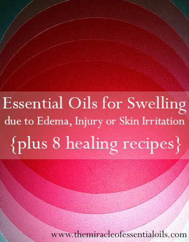 essential oils for swelling