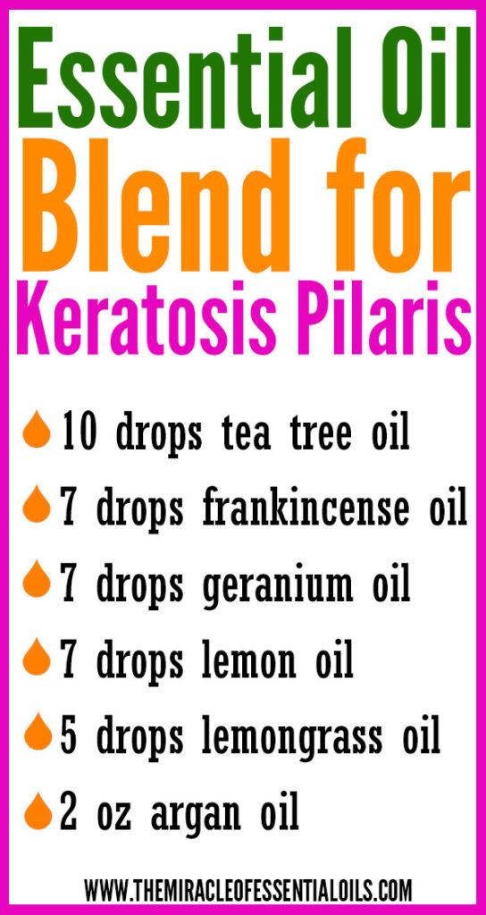 6 Essential Oils for Keratosis Pilaris with 5 Recipes to Use - The
