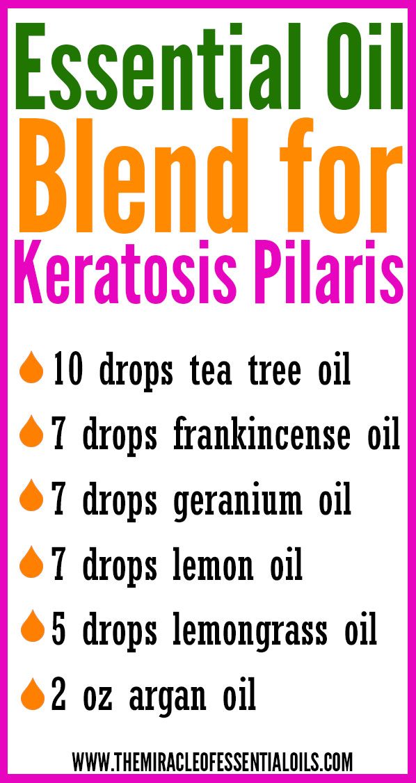 DIY Essential Oil Blend for Keratosis Pilaris