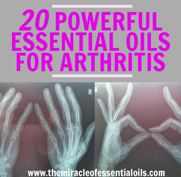 Top 20 Powerful Essential Oils for Arthritis Treatment The Miracle of