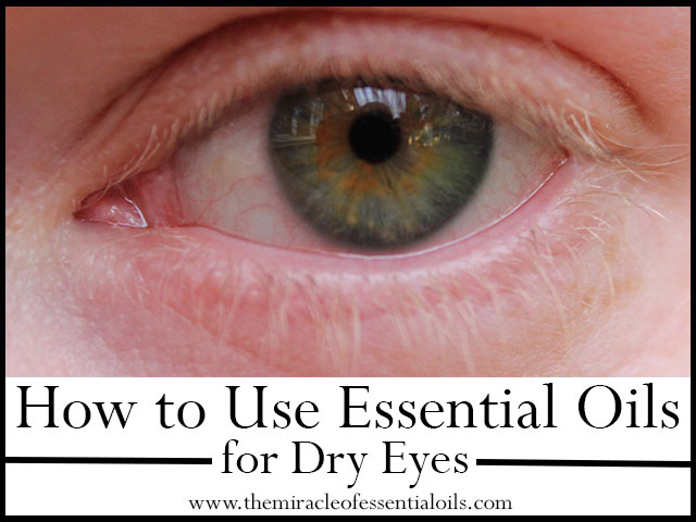 essential oils for dry eyes