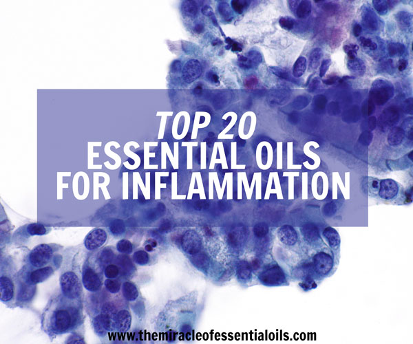 essential oils for inflammation