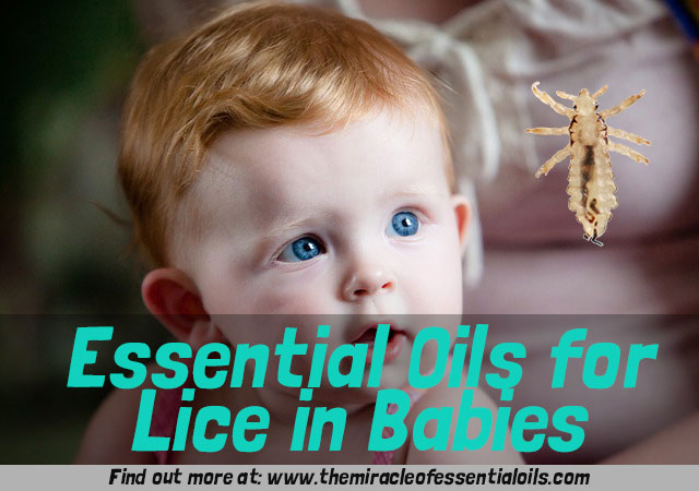 Using Essential Oils for Lice in Newborn Babies