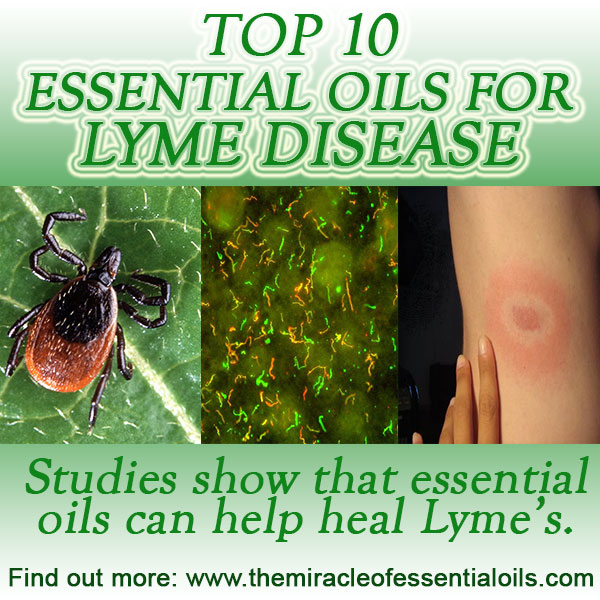 10 Essential Oils for Lyme Disease & Recipes to Use