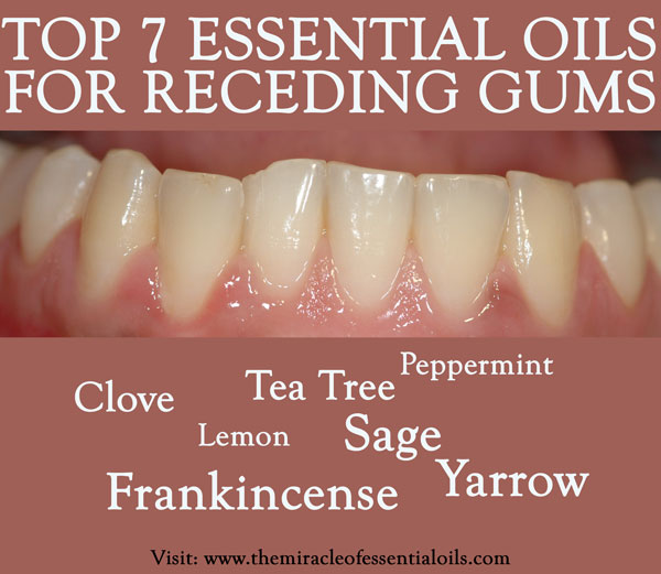 Grow Back Gums with Essential Oils for Receding Gums