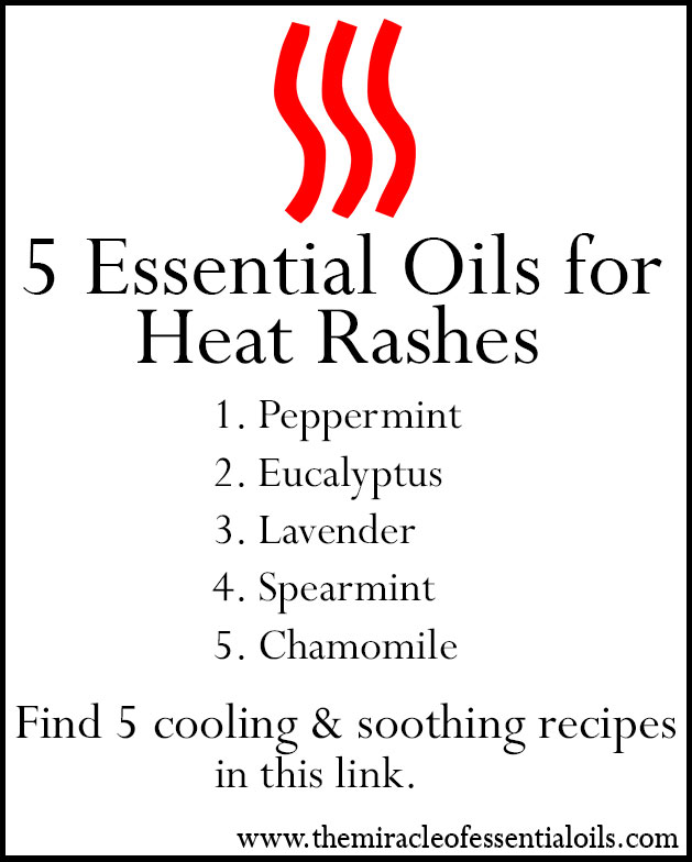 essential oils for heat rashes