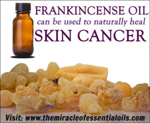 frankincense