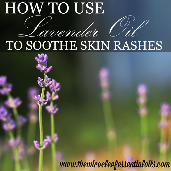 Lavender Oil for Skin Rash Treatment