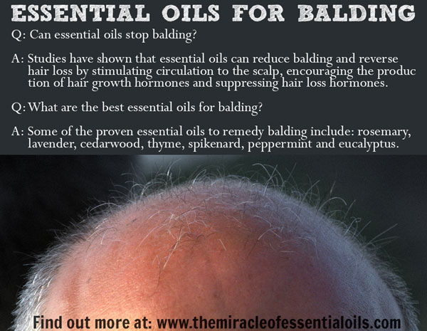 7 Essential Oils for Balding & How to Use