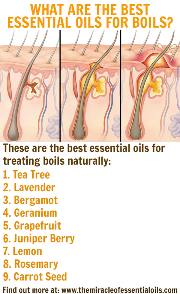 9 Best Essential Oils for Boils & DIY Recipes