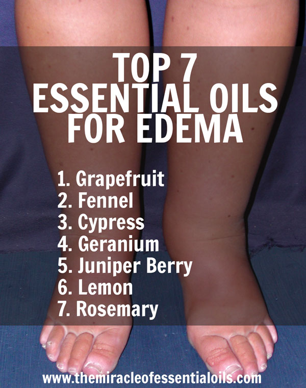 7 Essential Oils for Edema plus 3 Recipes to Use
