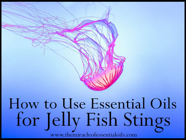 10 Relieving Essential Oils for Jelly Fish Stings