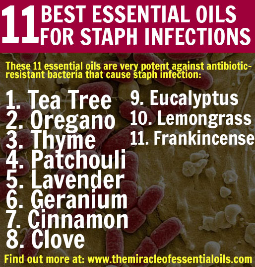 11 Powerful Essential Oils for Staph Infection