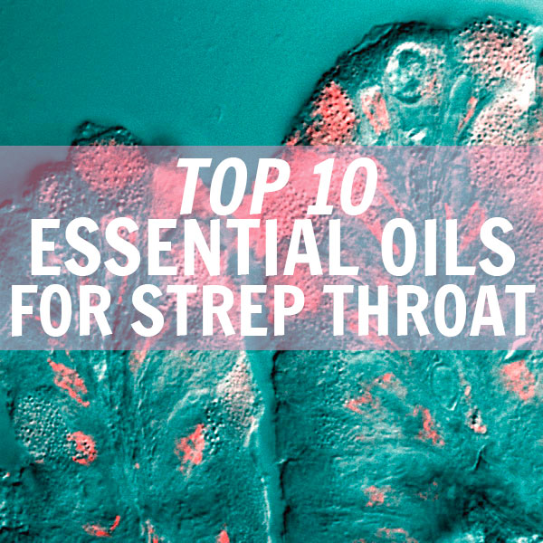 Top 10 Essential Oils for Strep Throat & 4 DIY Recipes that Work