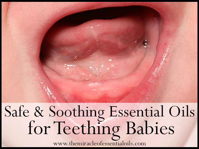 essential oils for teething