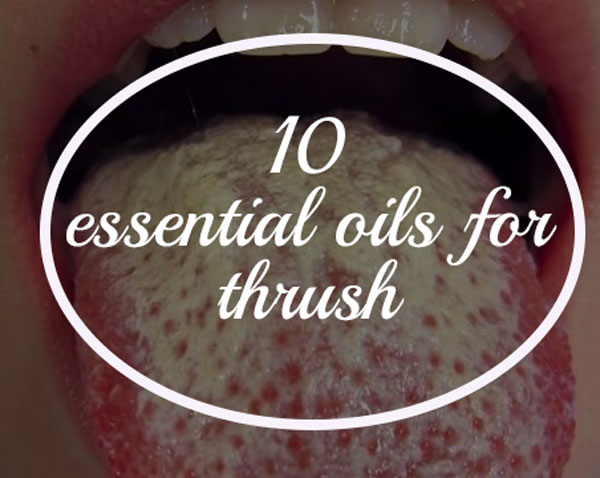 10 Essential Oils for Thrush & 2 DIY Treatment Recipes