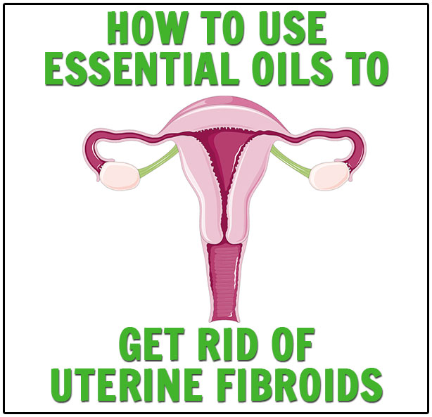 Essential Oils for Uterine Fibroids