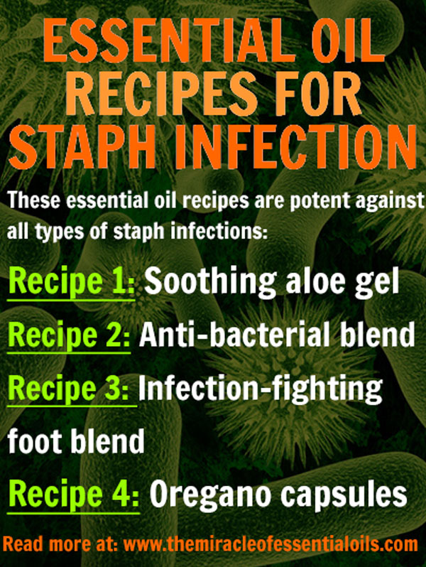 essential-oils-staph-infection-remedy-recipe