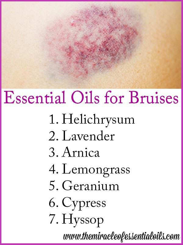 7 Essential Oils for Bruises & 2 Healing Recipes