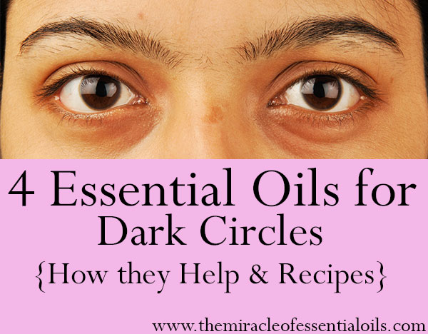 4 Best Essential Oils for Dark Circles