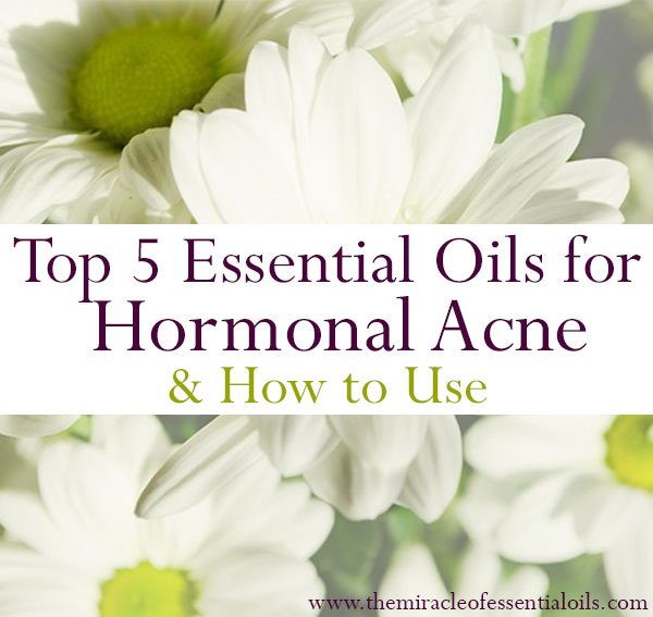 Top 5 Essential Oils for Hormonal Acne & How to Use