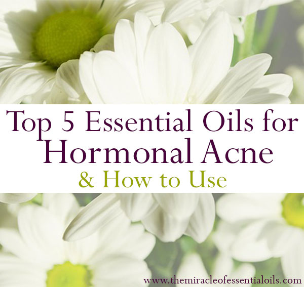 essential oils for hormonal acne