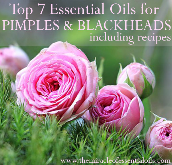 7 Essential Oils for Pimples and Blackheads & How to Use The Miracle