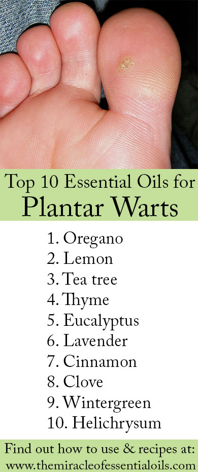 essential oils for plantar warts