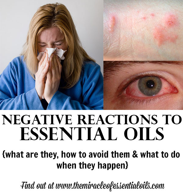 Dealing with Negative Reactions to Essential Oils