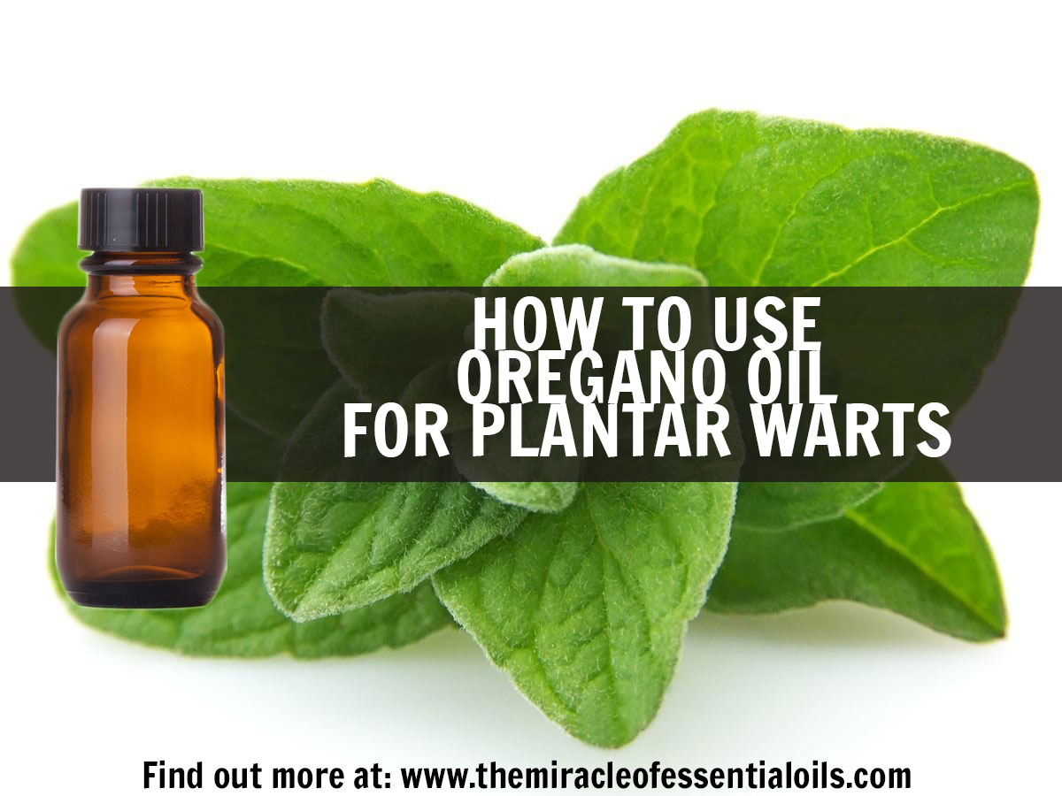 Use Oregano Oil for Plantar Warts