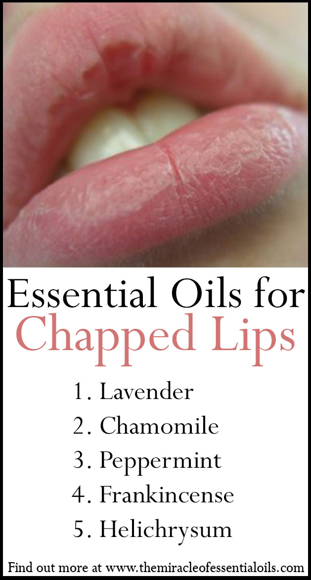 essential oils for chapped lips