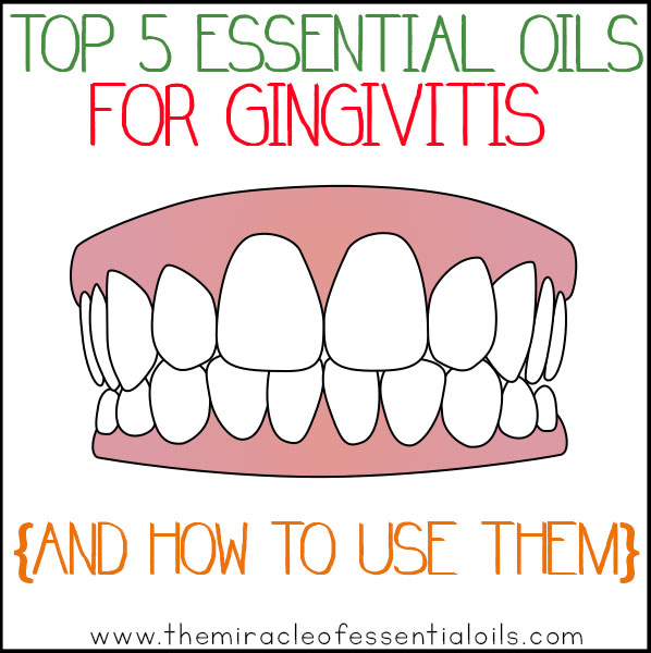 Top 5 Essential Oils for Gingitivitis