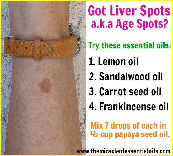 Top 4 Essential Oils for Liver Spots