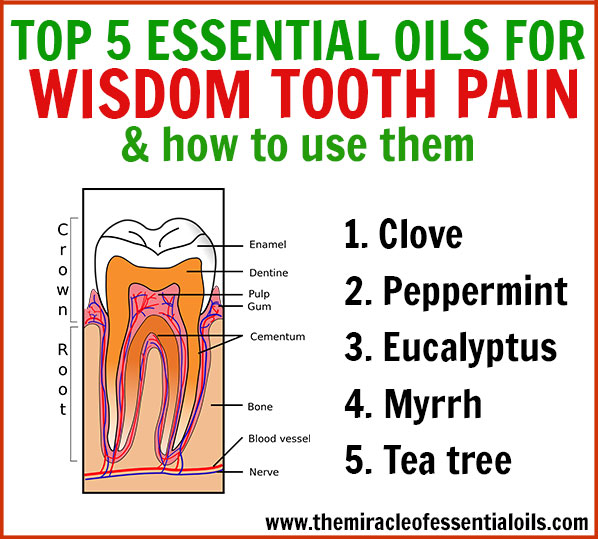 Got wisdom tooth pain! Ouch! Use these fast-acting essential oils for wisdom tooth pain relief! 