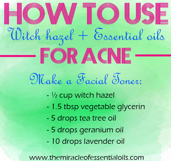 Witch Hazel and Essential Oils for Acne