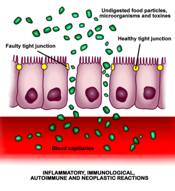 Leaky gut refers to increased intestinal permeability. Intestinal permeability simply refers to intestines being permeable. This means they have tiny spaces through which material passing from inside the gastrointestinal tract slips through to the rest of the body.