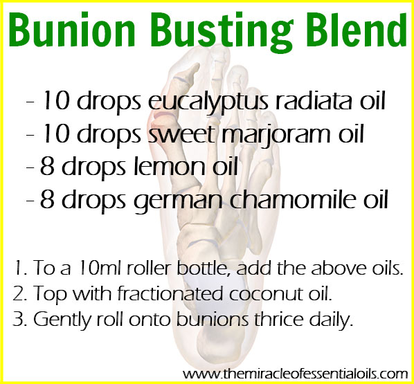 Got a bunion? Use this roller bottle blend as a natural treatment to relieve pain, inflammation and help dissolve the bunion