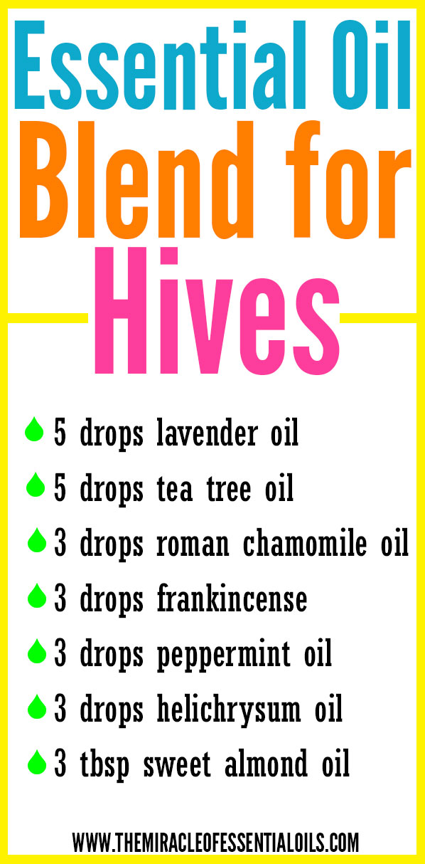 DIY Essential Oil Blend for Hives