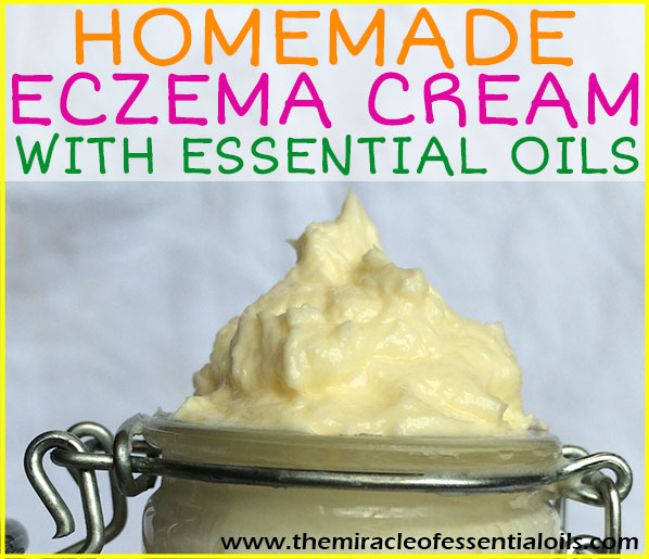 Find out how to make an easy DIY essential oil eczema cream in this post! 