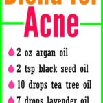 DIY Essential Oil Blend for Acne