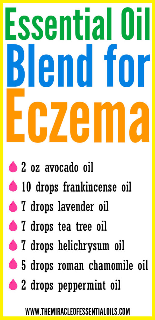 Find soothing relief fast using this DIY Essential Oil Blend for Eczema! 