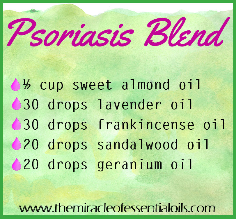 Find promising relief with this DIY essential oil blend for psoriasis.